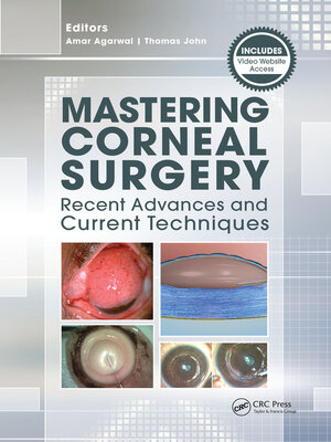 cover image of Mastering Corneal Surgery